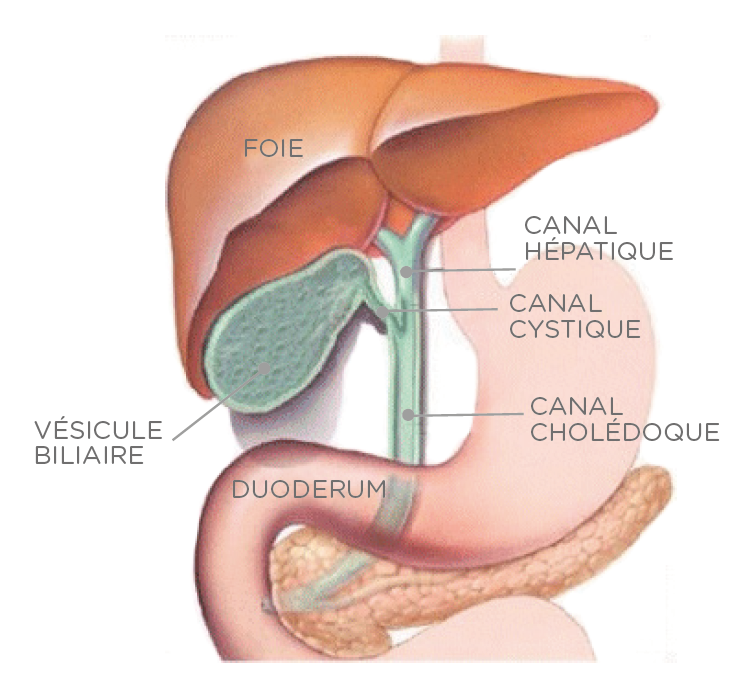 Cholécystectomie (Ablation de la vésicule biliaire) | CHL
