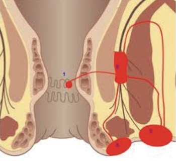 Les pathologies coloproctologiques | CHL