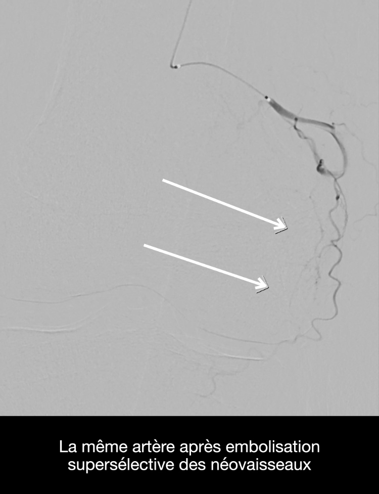 Image radiologique