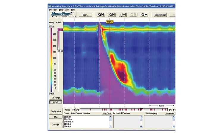 Image d'endoscopie