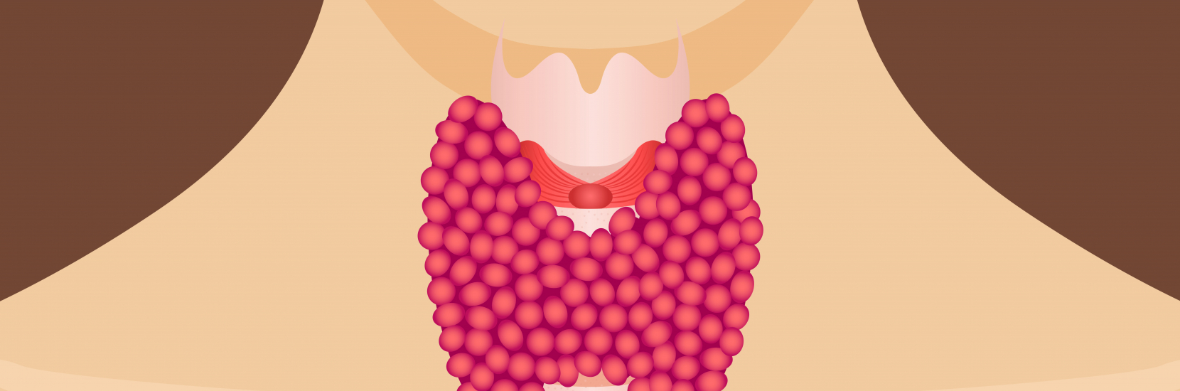 Hypothyroidie congénitale