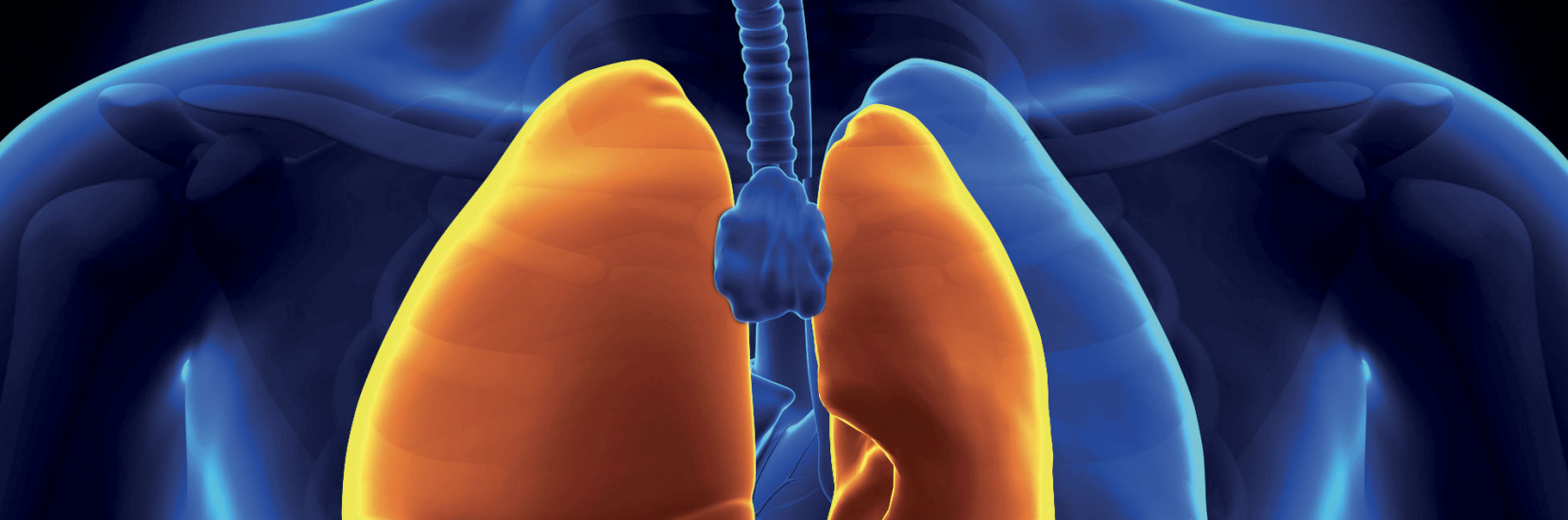 Le pneumothorax | CHL