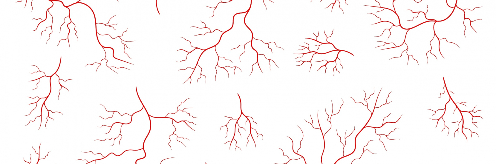 La prise en charge des varices : 5 questions au Dr Pillet