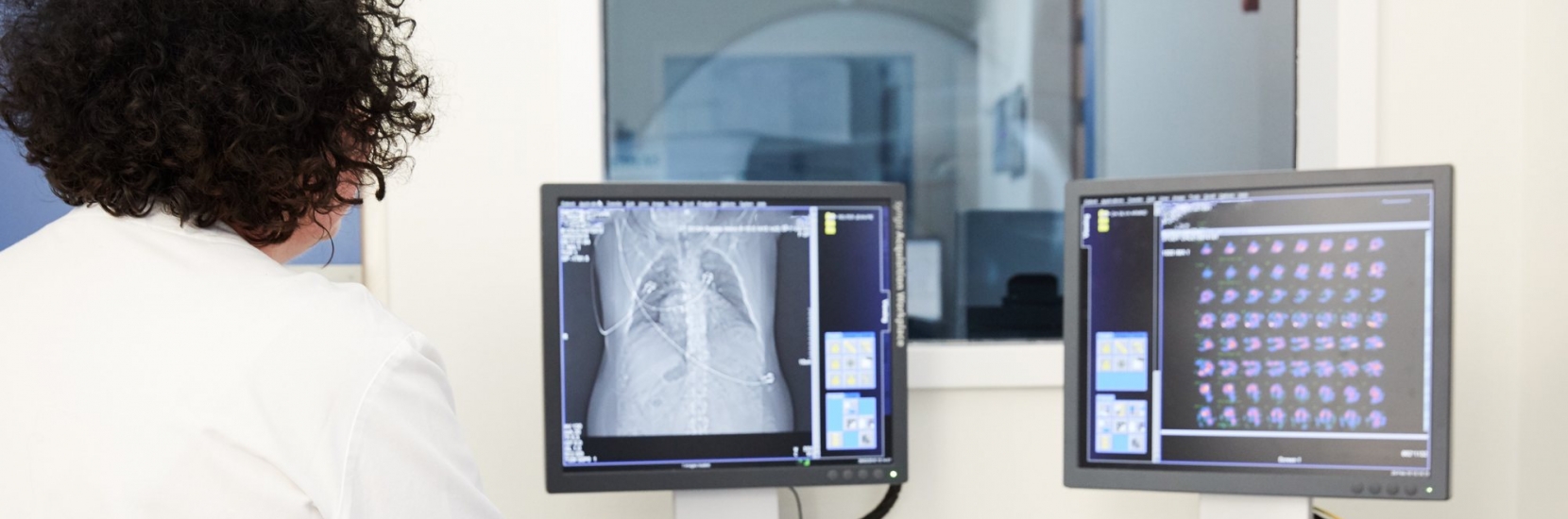 Tomoscintigraphie Myocardique de perfusion et de fonction (SPECT/CT)